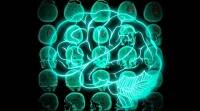 大脑扫描仪检测减肥成功: 研究